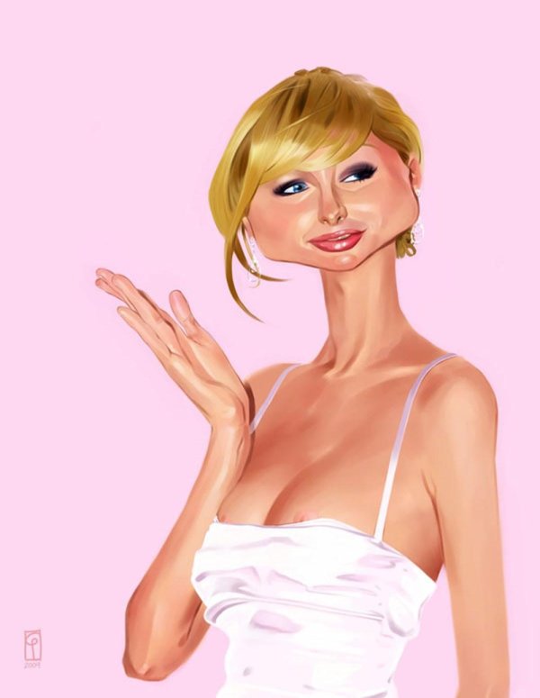 пэрис хилтон до пластики