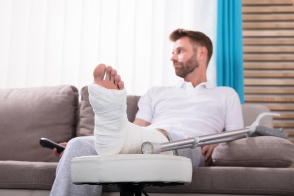 patient with broken leg