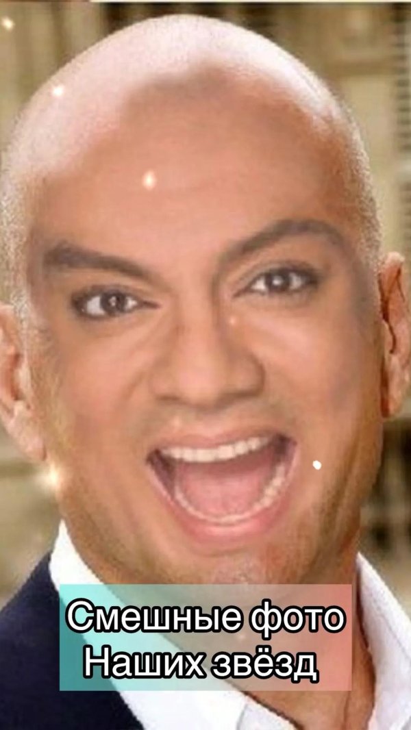 лысый киркоров