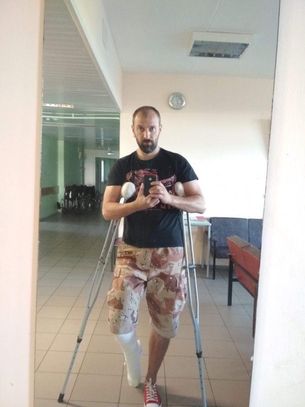 сломала ногу
