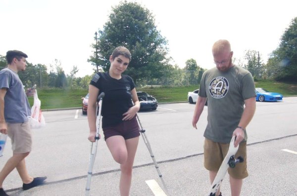 одноногая женщина на костылях