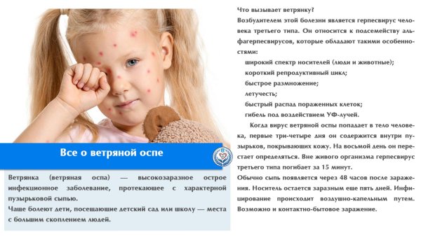 ветрянка у детей