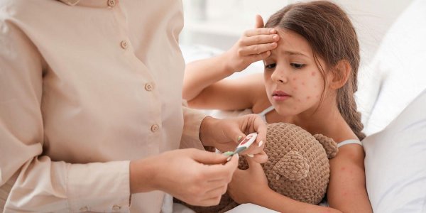 ветрянка у детей