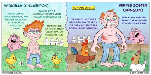 varicella zoster virus