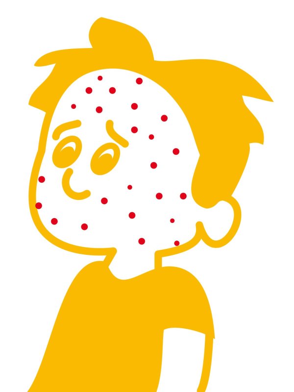 ветрянка рисунок