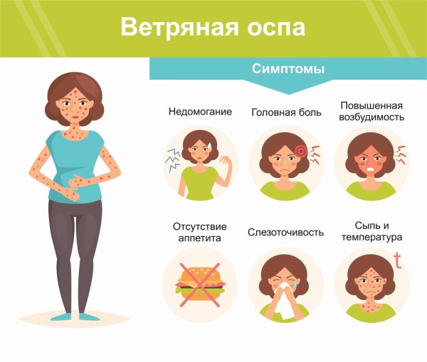 меры профилактики ветряной оспы