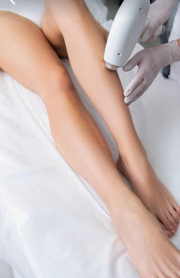 эпиляция ног