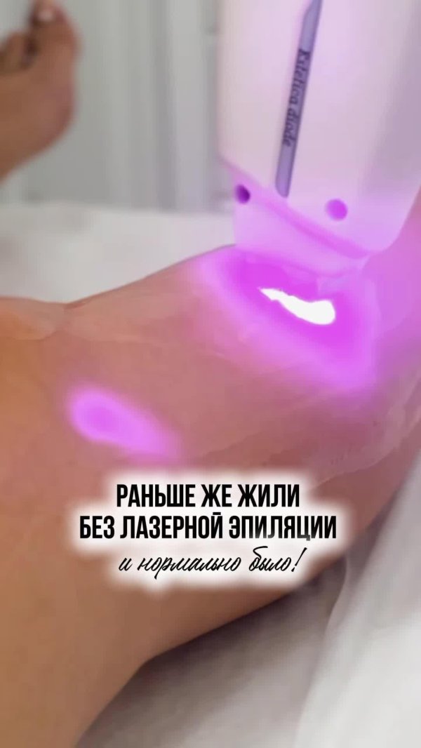 эпиляция лазером