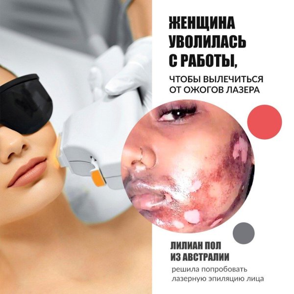 лазерное омоложение лица реклама