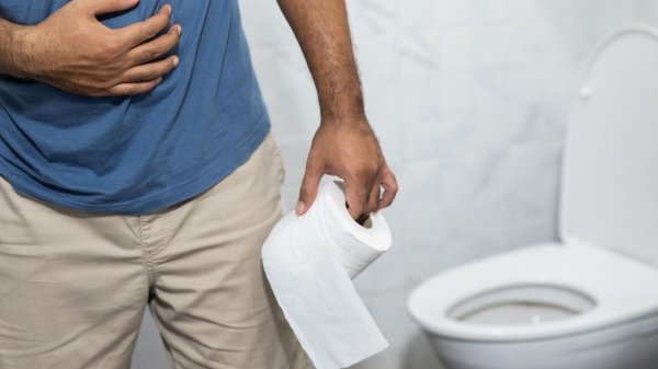 constipation treatment