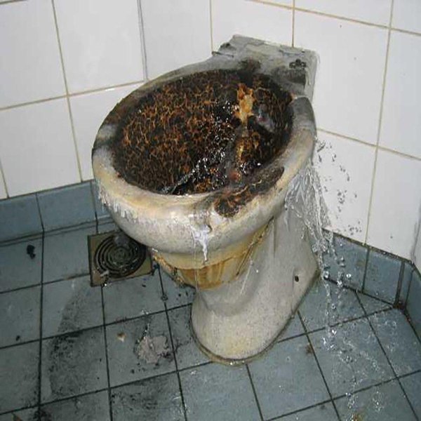 Диарея