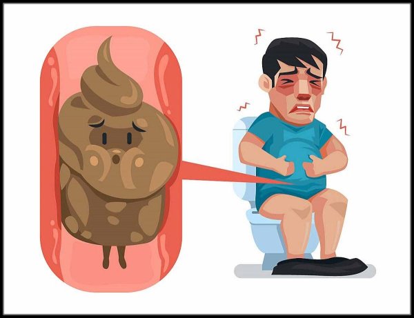 средства от запора