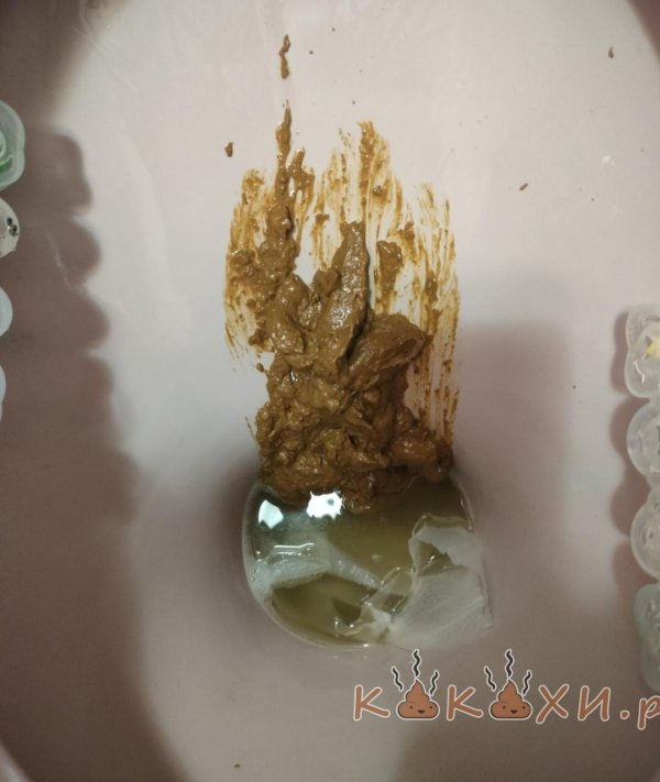 жидкий понос