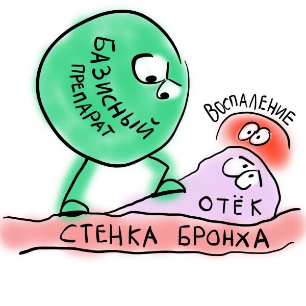 острый бронхит