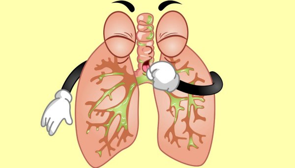 лечение бронхита