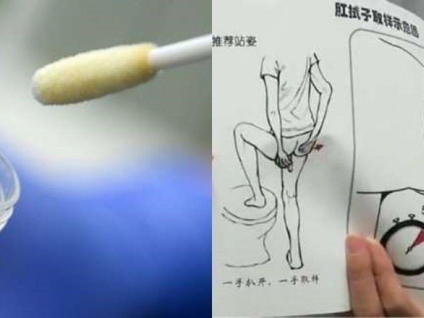 ректального мазка