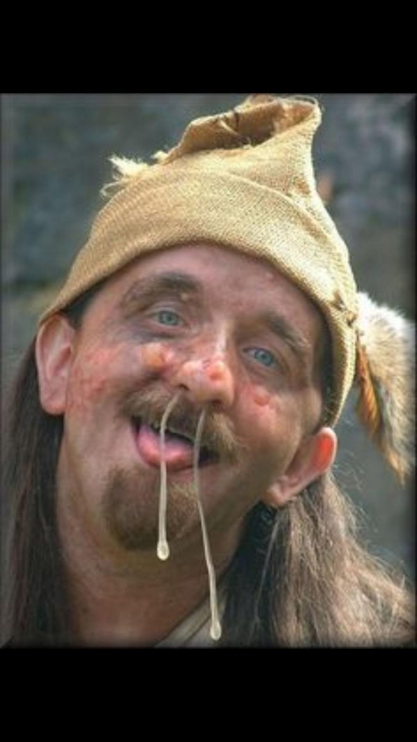 уродливый бомж