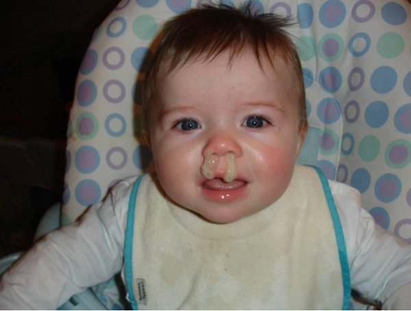 зеленые сопли