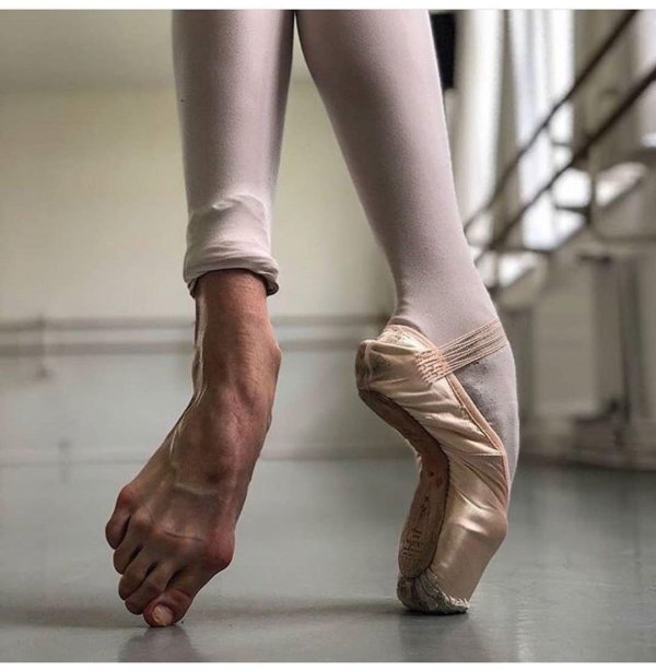 ноги балерин после пуантов