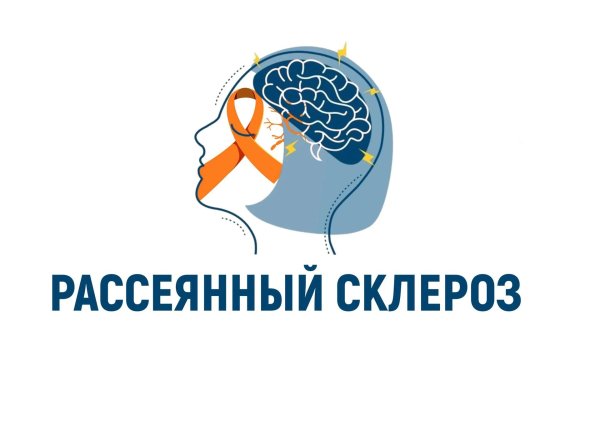рассеянный склероз неврология