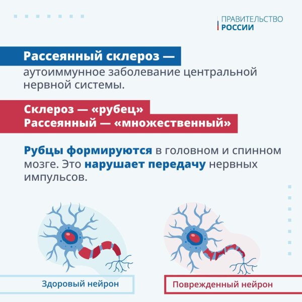 рассеянный склероз
