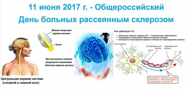 общероссийский день рассеянного склероза