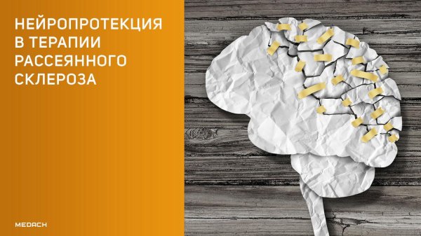 рассеянный склероз неврология