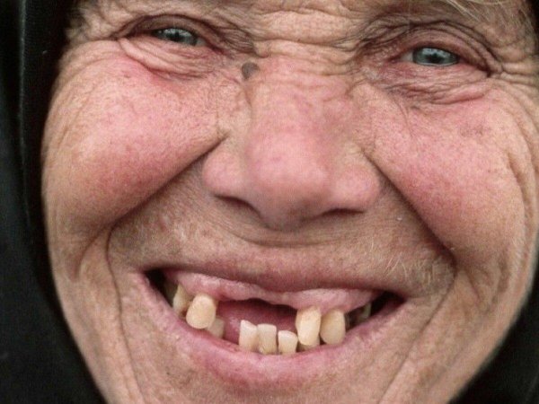 беззубый рот