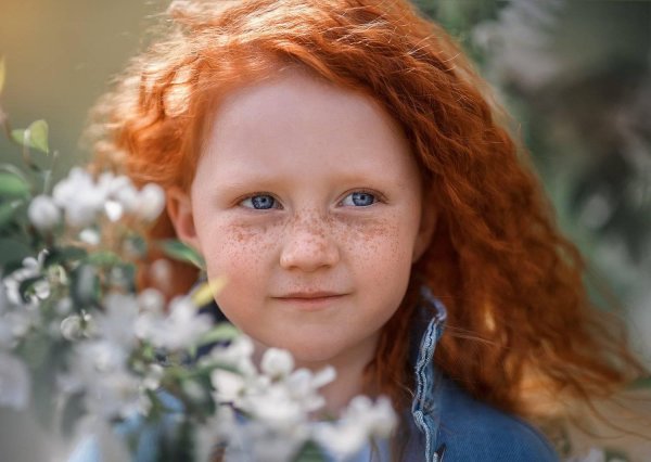 веснушки у детей