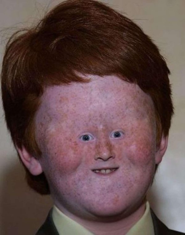 uglyfacekid лицо