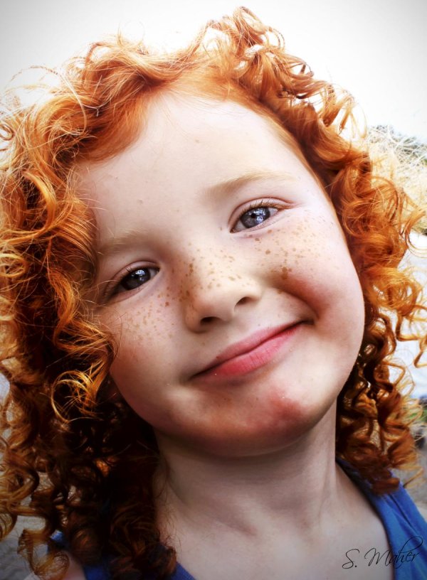 веснушки у детей