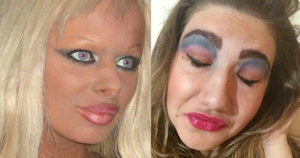 неудачная пластическая операция