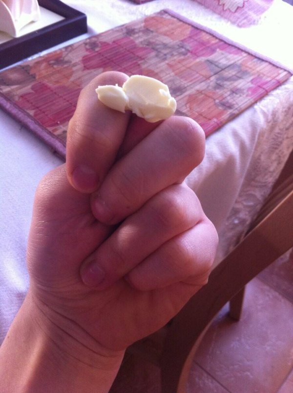 комок в горле и белые комочки