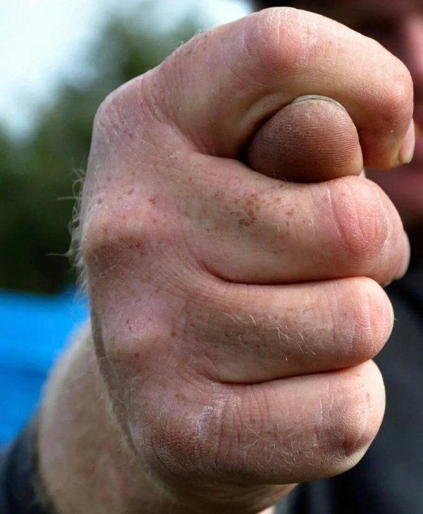 кулаки после драки