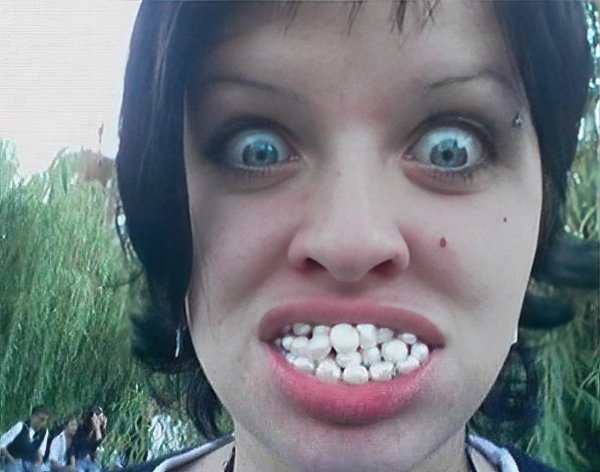 брекеты улыбка