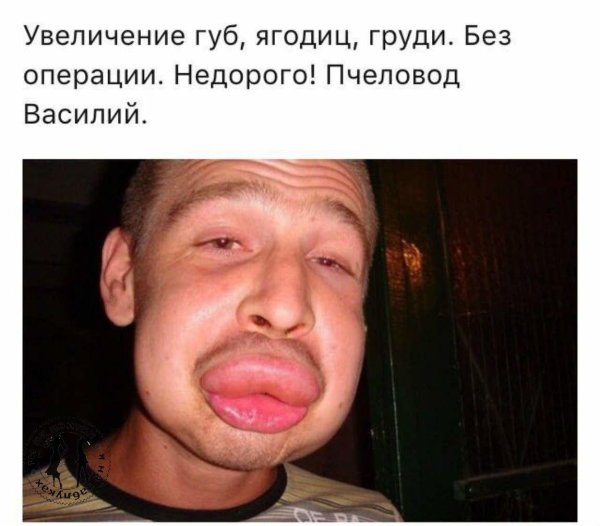 покусанный пчелами