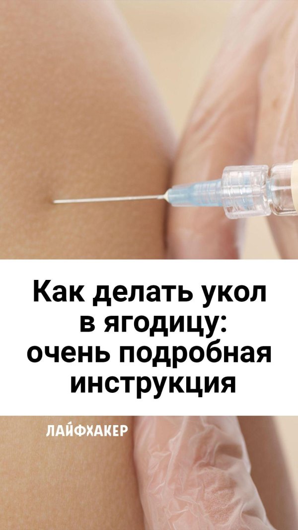 Укол в ягодицу женщине