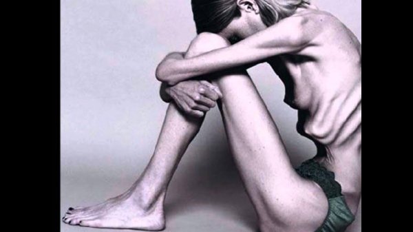 нервная анорексия