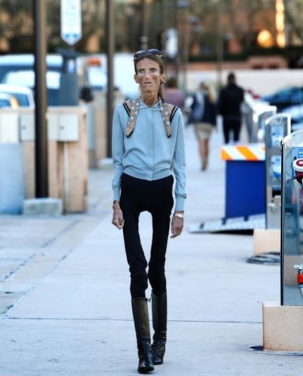 самые худые люди