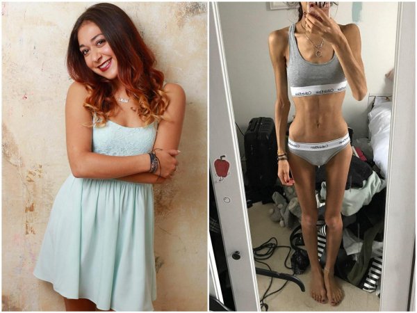 анорексичка дарья пархоменко