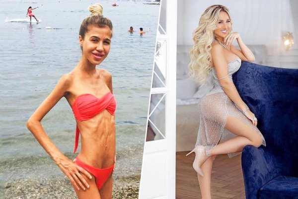 маша кохно анорексия