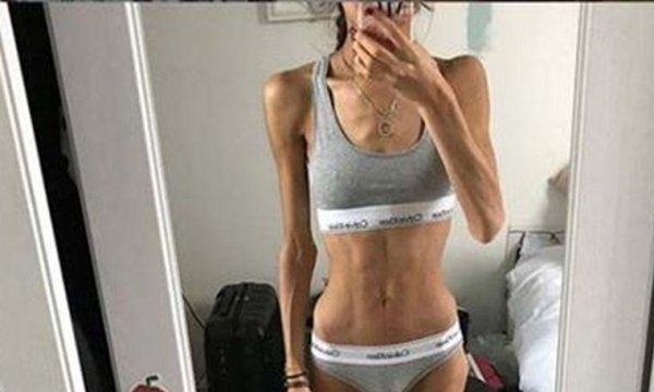 ксения шарипова анорексия