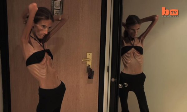 валерия кошкина анорексичка