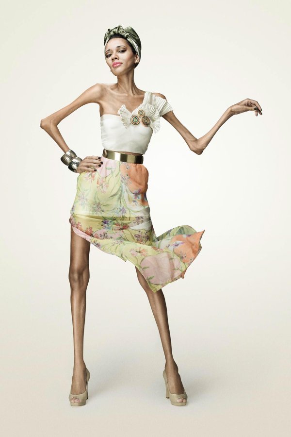 люди страдающие анорексией