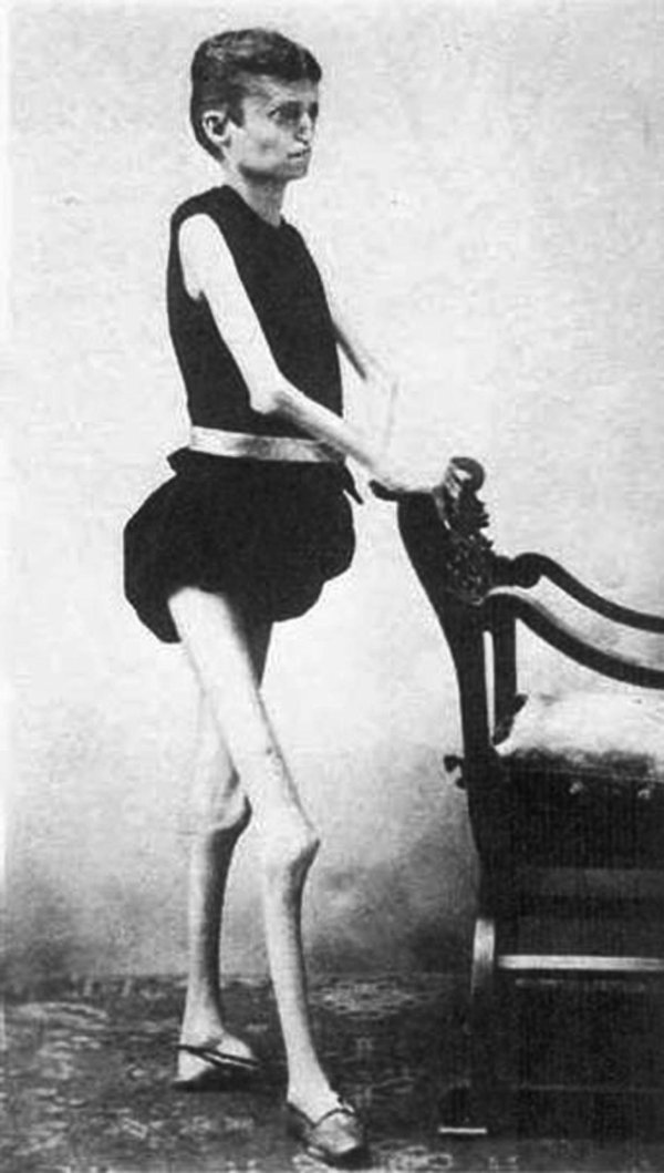 исаак спрэг