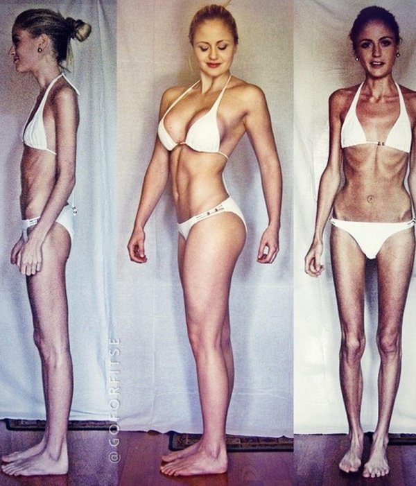 эндоморф анорексик