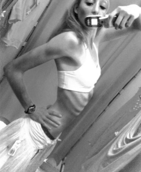 анорексичка дарья пархоменко