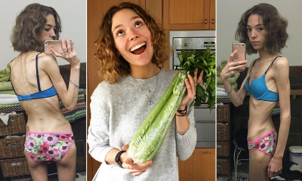 кристина анорексичка