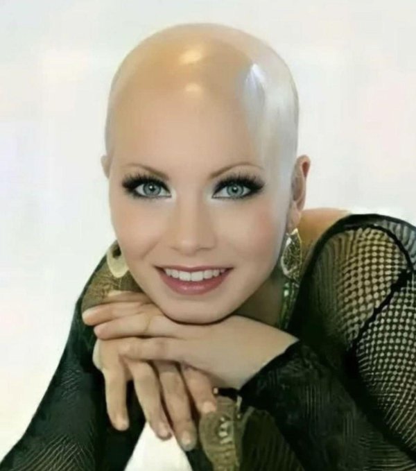лысые женщины