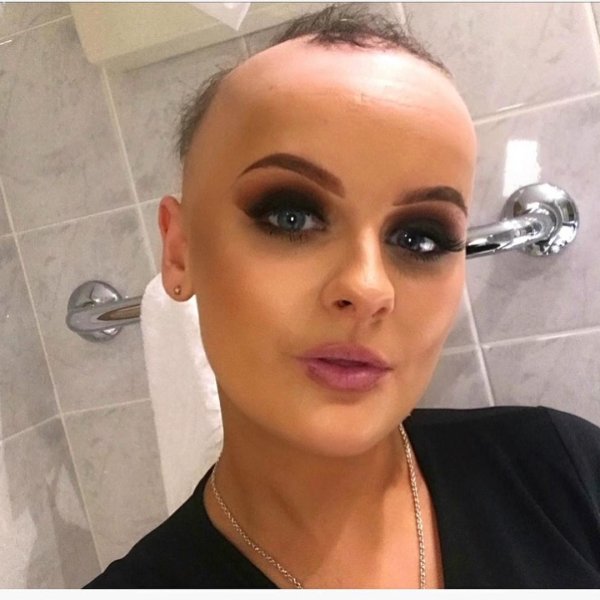 лысые девушки
